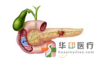 通过递送microRNA来治疗炎性肠病