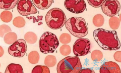 成人急性淋巴细胞白血病：基础及前沿，你需要知道的都在这儿