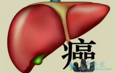 都说肝癌很难治疗，做好这4件事，不让肝癌“靠近”你