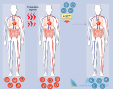 多发性骨髓瘤的危害有哪些?