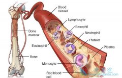 多发性骨髓瘤怎么去控制?