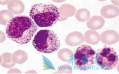 多发性骨髓瘤药物有哪些副作用