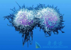 多发性骨髓瘤的患病原因有哪些