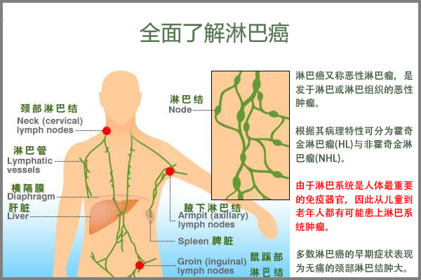 淋巴肉芽肿血常规