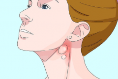 淋巴瘤的具体症状有哪些