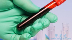 如何预防淋巴瘤？