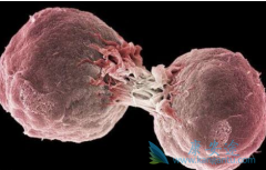 淋巴瘤的晚期症状有哪些