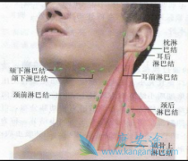 淋巴瘤早期症状有哪些?
