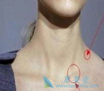 淋巴瘤样丘疹病可以并发哪些疾病？