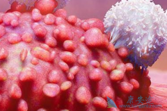 淋巴瘤样丘疹病是由什么原因引起的？