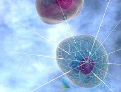 淋巴瘤细胞白血病是由什么原因引起的？