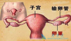卵巢癌的5大诱发因素