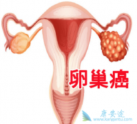 什么是造成了卵巢癌的主要病因