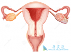 什么是主要的诱发出现的卵巢癌的病因