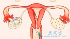内分泌因素在卵巢癌的原因中起很大作用