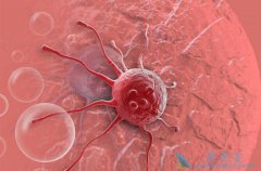 中医如何治疗肾癌3种中药能缓解症状