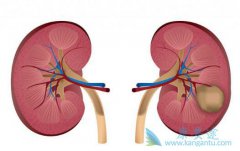 肾癌服用多吉美会产生什么效果