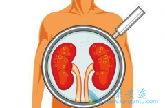 肾癌的检查项目包括什么？