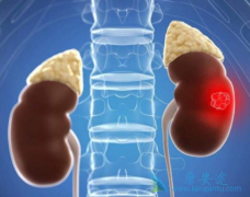 肾癌手术后的并发症有哪些？