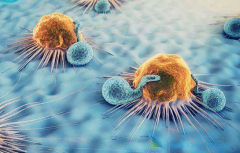 导致肾癌复发的原因