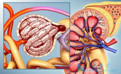 肾癌转移的治疗方法