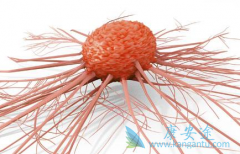 有什么方法预防肾癌