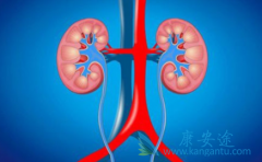 关于如何护理肾癌患者