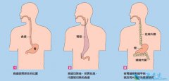 食道癌的内镜诊断常识有哪些?