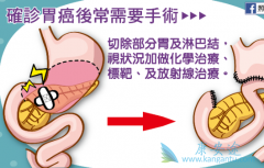 胃癌的癌前疾病有哪些?